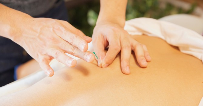 Discover the Healing Power of Acupuncture image